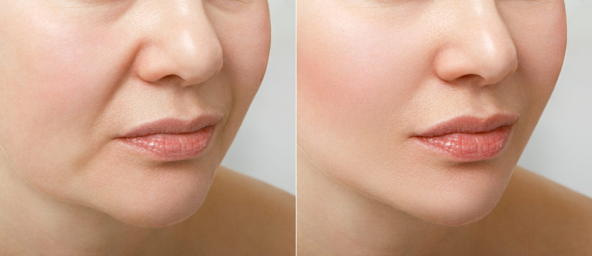 before your facelift procedure information provided by Aspire Surgical in the Salt Lake City, UT area