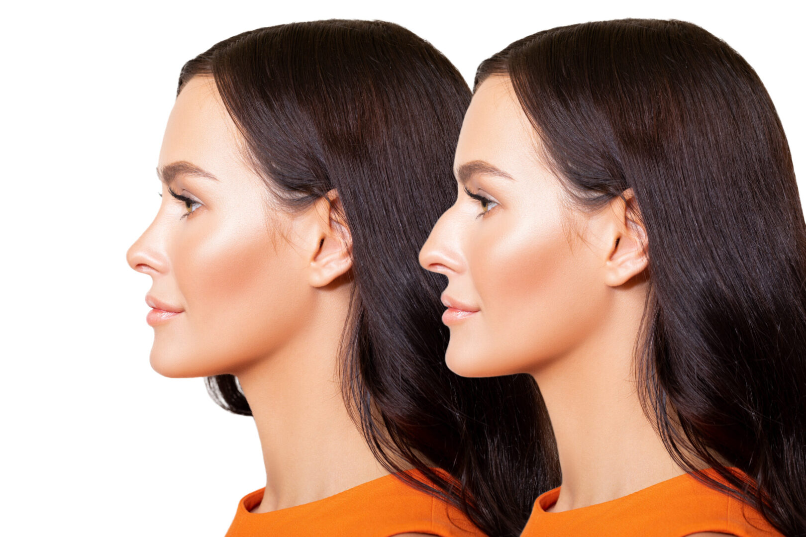 nose revision rhinoplasty to fix the shape of your nose with Aspire Surgical in Salt Lake City, UT